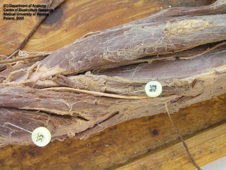 Szpilki -Grzbiet i kończyna górna - m. extensor carpi radialis longus sin., n. radialis sin.jpg